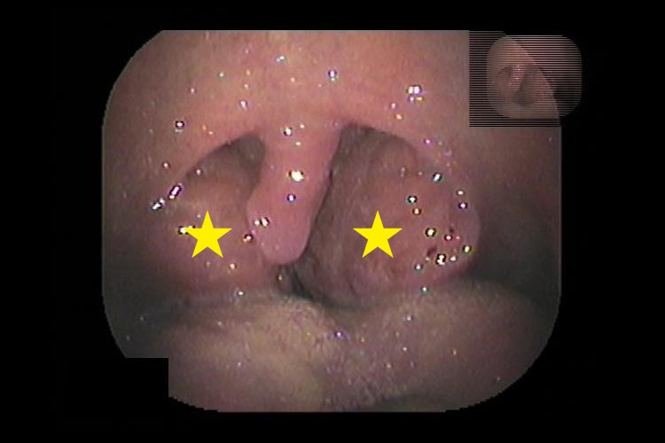 治療の流れ・料金画像4