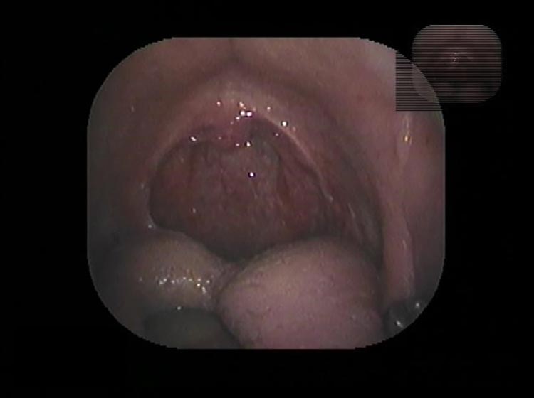 治療の流れ・料金画像6